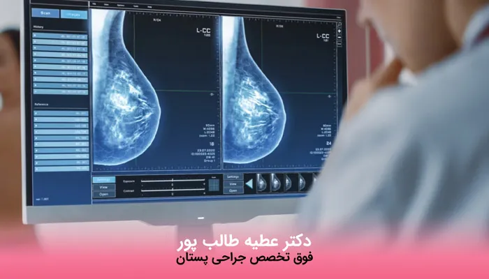 روش تشخیص توده خوش خیم سینه