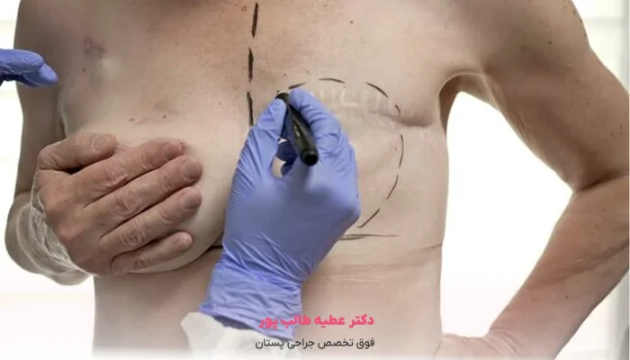 مزایای جراحی بازسازی سینه