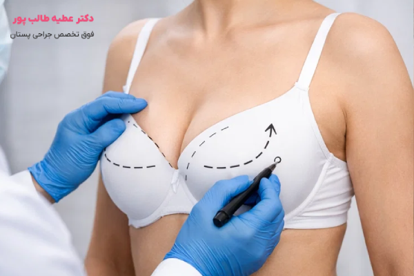 مراحل عمل لیفت سینه