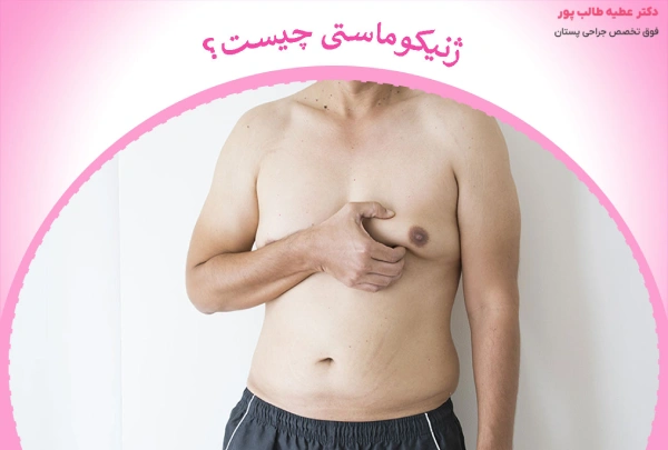 ژنیکوماستی