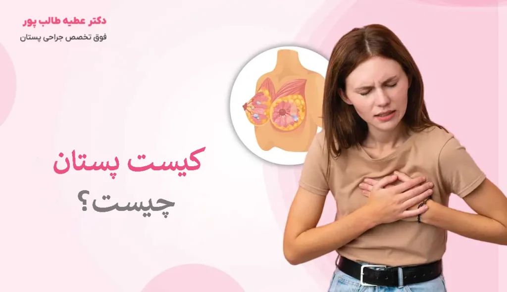 کیست پستان چیست؟